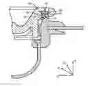 Fig. 01 - Valve for an inflatable device