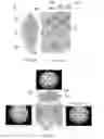 Fig. 08 - MICROFLUIDIC CHIP FOR MULTI-ANALYTE DETECTION