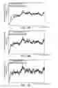 Fig. 09 - Detecting device, fish finder and detecting method
