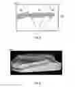 Fig. 10 - IDENTIFYING AND EXTRACTING FLUID LAYERS AND FLUID RESERVOIRS IN ONE OR MORE BODIES REPRESENTING A GEOLOGICAL STRUCTURE