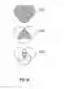 Fig. 24 - IDENTIFYING AND EXTRACTING FLUID LAYERS AND FLUID RESERVOIRS IN ONE OR MORE BODIES REPRESENTING A GEOLOGICAL STRUCTURE