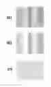 Fig. 01 - Apparatus and method for processing document image to estimate luminance image from luminance component image adjusted according to estimated or largest luminance values and predetermined criterion