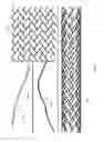 Fig. 09 - Device specific finite element models for simulating endovascular treatment