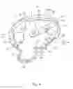 Fig. 05 - Vibration motor