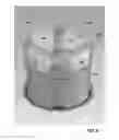 Fig. 09 - CAPSULE ENDOSCOPE