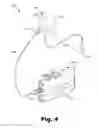 Fig. 05 - Systems and methods for facilitating electroacoustic stimulation using an off-the-ear sound processor module
