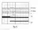Fig. 05 - Control loop with a variable time constant for power factor correction for a load circuit comprising light-emitting means