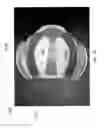 Fig. 35 - Helmet padding system