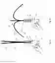 Fig. 07 - Umbrella-like Device Using Flexible Ribs