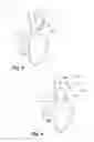 Fig. 04 - Hair styling device