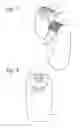 Fig. 06 - Epilating device having open configuration