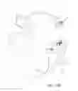 Fig. 35 - Surgical visualization systems