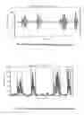 Fig. 43 - Method of processing cardiovascular sound signals