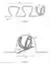 Fig. 02 - Embolic framing microcoils