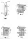 Fig. 02 - Distraction screw