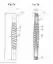Fig. 08 - ELASTIC ELEMENT FOR THE USE IN A STABILIZATION DEVICE FOR BONES AND VERTEBRAE AND METHOD FOR THE MANUFACTURE OF SUCH ELASTIC ELEMENT