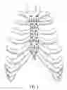 Fig. 02 - Bone fixation implants