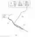 Fig. 02 - Flexible electrosurgical ablation and aspiration electrode with beveled active surface