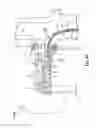 Fig. 07 - Self-expanding cooling electrode for renal nerve ablation