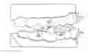 Fig. 01 - Dental appliance with repositioning jaw elements