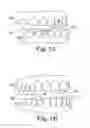 Fig. 02 - Dental appliance with repositioning jaw elements