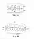 Fig. 04 - Dental appliance with repositioning jaw elements