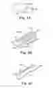 Fig. 06 - Dental appliance with repositioning jaw elements