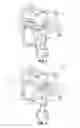 Fig. 02 - Orthodontic appliances including ferromagnetic shape memory alloys and methods of orthodontic treatment using same