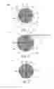 Fig. 02 - Hemostasis and closure methods utilizing mesh