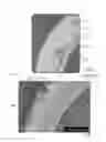 Fig. 02 - VASCULAR GRAFTS AND METHOD FOR PRESERVING PATENCY OF THE SAME