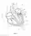 Fig. 02 - Treatment catheter system