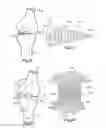 Fig. 10 - JOINT SPACER