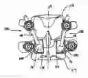 Fig. 01 - Polyaxial adjustment of facet joint prostheses