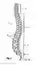Fig. 02 - Polyaxial adjustment of facet joint prostheses