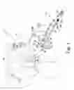 Fig. 02 - Surgical instrument and method of positioning an acetabular prosthetic component