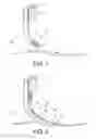 Fig. 02 - Prosthetic device, system and method for increasing vacuum attachment