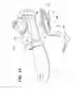 Fig. 12 - Prosthetic device, system and method for increasing vacuum attachment