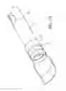 Fig. 22 - Stent delivery system with pusher assembly