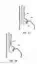 Fig. 08 - METHODS OF REPLACING A GASTROINTESTINAL BYPASS SLEEVE FOR THERAPY ADJUSTMENT