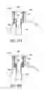 Fig. 43 - METHODS OF REPLACING A GASTROINTESTINAL BYPASS SLEEVE FOR THERAPY ADJUSTMENT