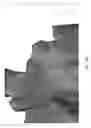 Fig. 06 - Custom reduction splint for edentulous patients