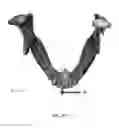 Fig. 08 - Custom reduction splint for edentulous patients