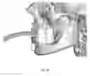 Fig. 27 - Custom reduction splint for edentulous patients