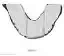 Fig. 40 - Custom reduction splint for edentulous patients