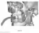 Fig. 48 - Custom reduction splint for edentulous patients