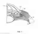 Fig. 02 - Glaucoma treatment device