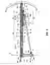 Fig. 04 - Telescoping and elevating femoral support