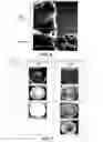 Fig. 06 - Manufacture of nonelectronic, active-infusion patch and device for transdermal delivery across skin