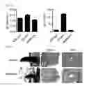 Fig. 02 - COMPOSITION USING METFORMIN FOR PREVENTING OR TREATING IMMUNE DISEASES INCLUDING LUPUS