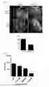 Fig. 04 - COMPOSITION USING METFORMIN FOR PREVENTING OR TREATING IMMUNE DISEASES INCLUDING LUPUS